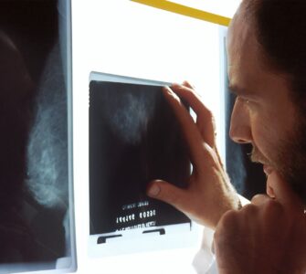 The Hidden Burden of Delayed Diagnosis