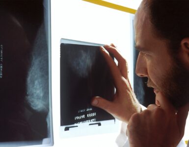 The Hidden Burden of Delayed Diagnosis